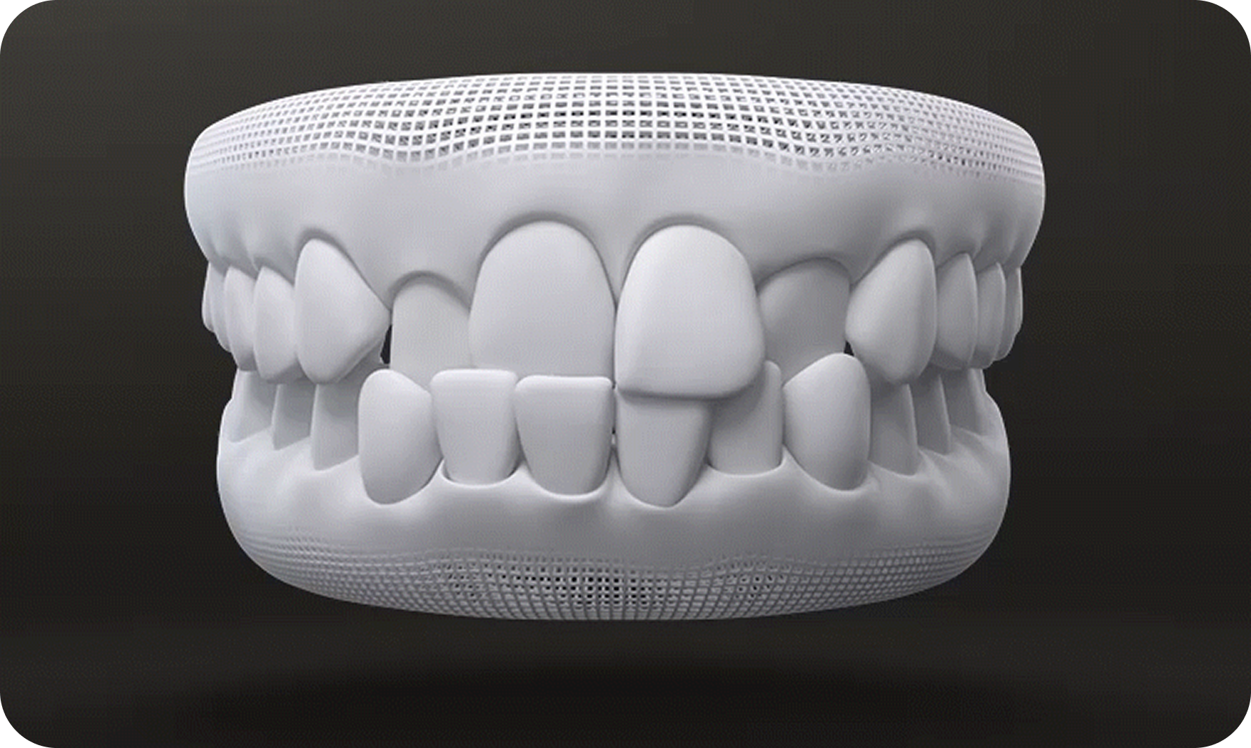 삐뚤삐뚤한 앞니교정