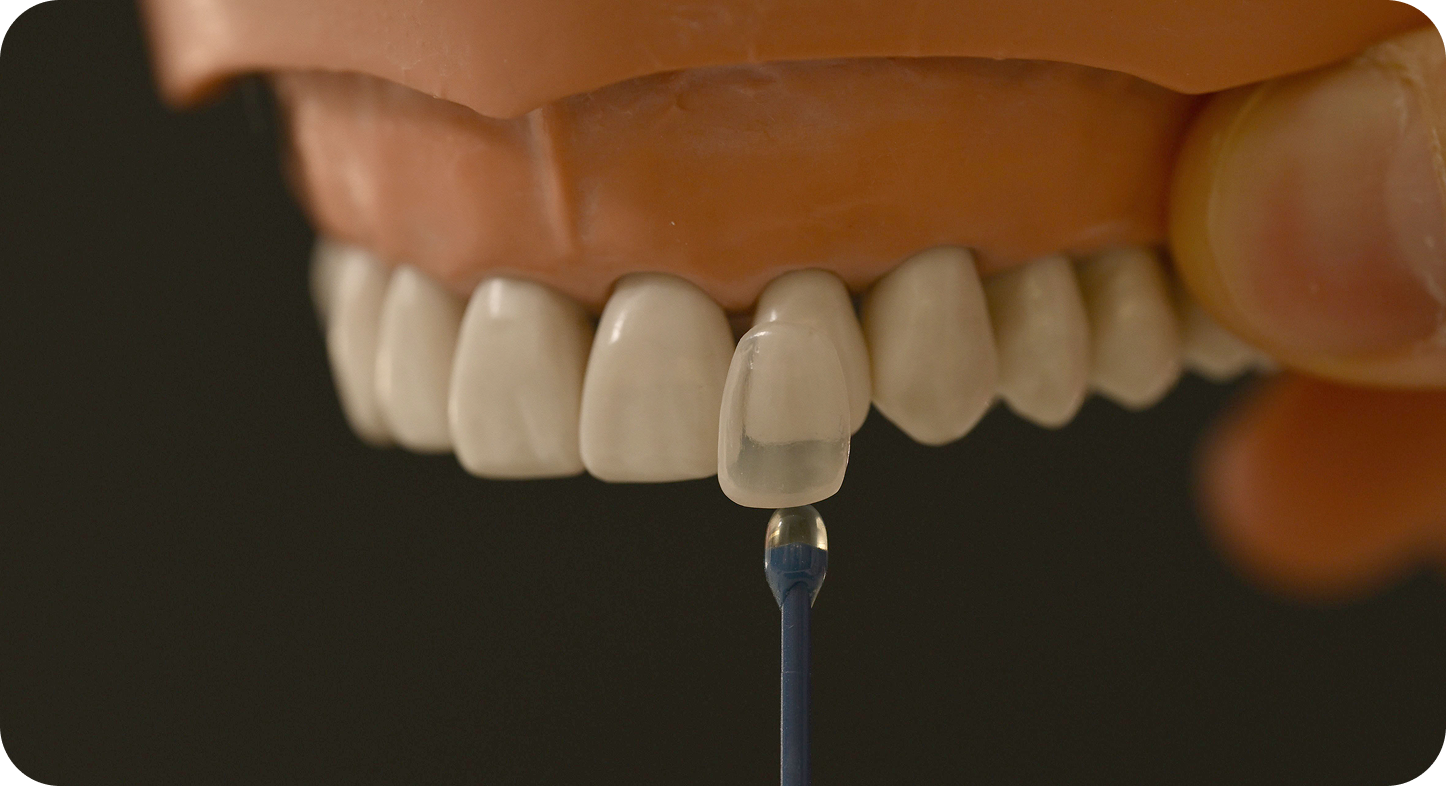 라미네이트 이미지 3