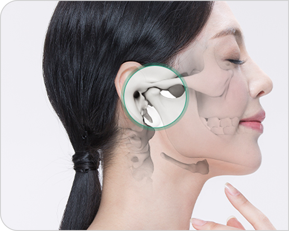 턱관절 자극 치료